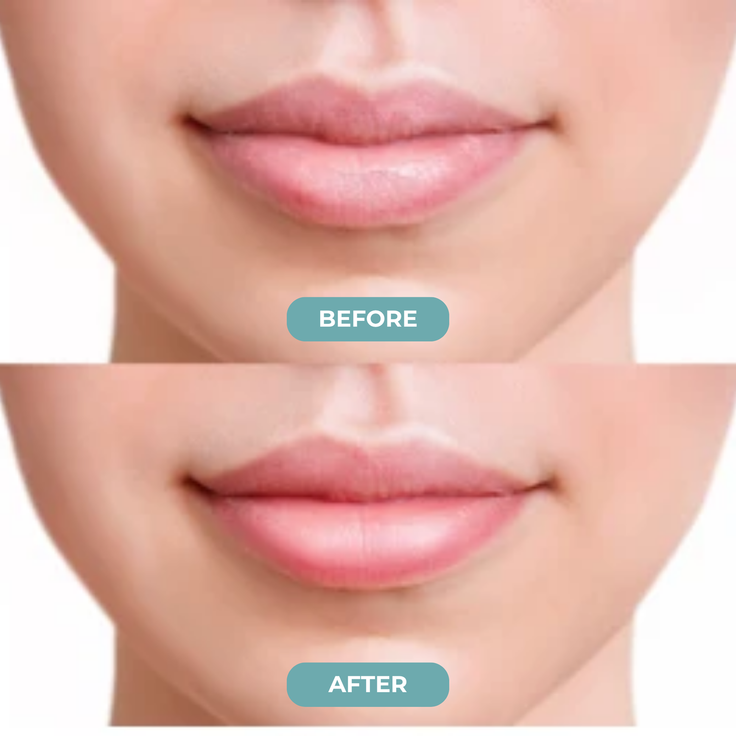 Nuvea - Beauty Lip Mask